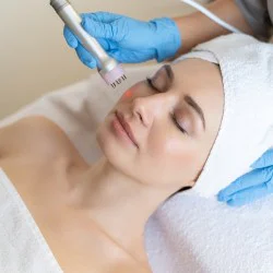 Красива и стегната кожа без бръчки с Радиочестотен лифтинг на лице в Пловдив