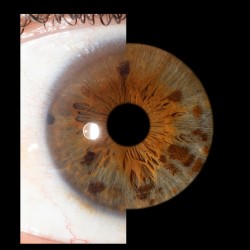 Превърнете вашите очи в уникална картина с ирисова фотография в София- заснемане на четири ириса