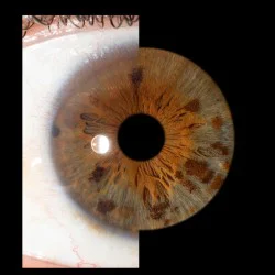 Превърнете вашите очи в уникална картина с ирисова фотография в София- заснемане на четири ириса